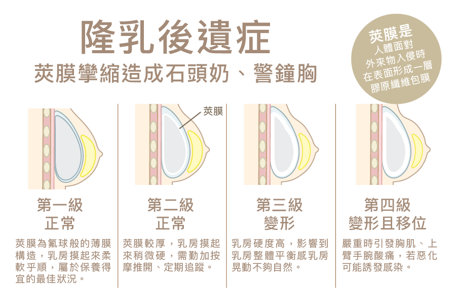 術後管理 - MirrorSkin